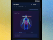 Jona Microbiome Test Review: Microbiome Decoder for Health Conditions
