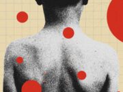 The Backward Logic of Chickenpox Parties