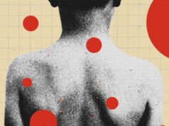 The Backward Logic of Chickenpox Parties