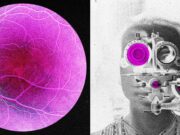 Longevity Startup Doses First Human in Bid to Reverse Age-Related Sight Loss