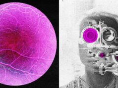 Longevity Startup Doses First Human in Bid to Reverse Age-Related Sight Loss