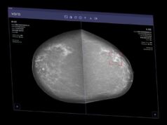 AI Can Now Clear Some Mammograms Without a Radiologist’s Review